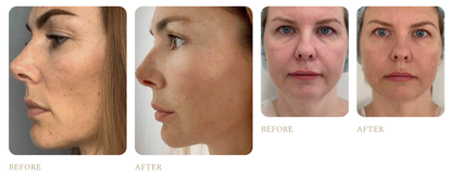 Artistic&Co. Dr. Arrivo Zeus II PLUS Black Beauty Device